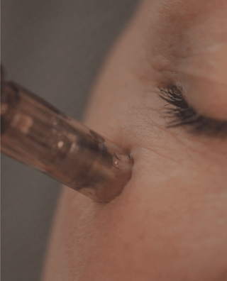 Why February is the time to try microneedling - The Light Salon
