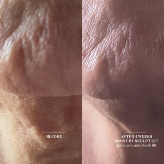 bt-sculpt Facial Tool