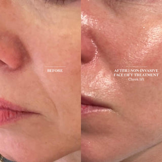 bt-sculpt Facial Tool