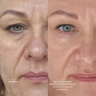 bt-sculpt Facial Tool