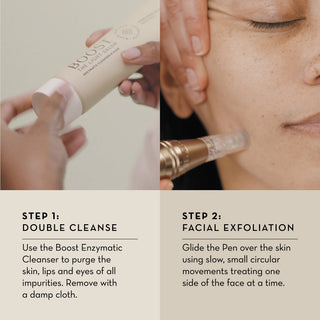 Boost Nano - Dermabrasion Pen (+12 Tips) - The Light Salon